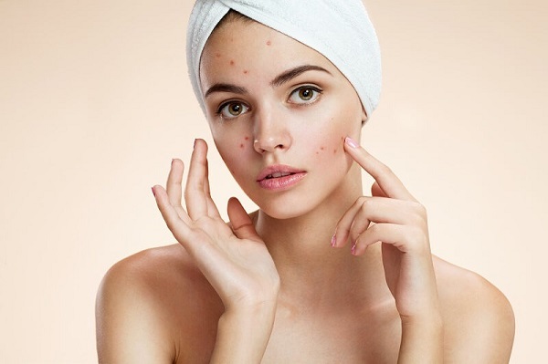 càng skincare càng lên mụn