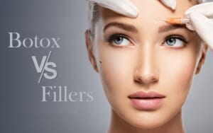 Botox hay filler tốt hơn