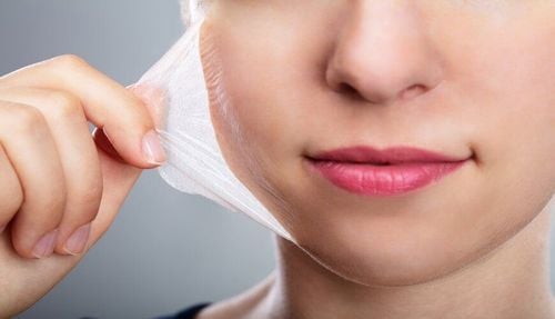 Peel da tại nhà có an toàn không