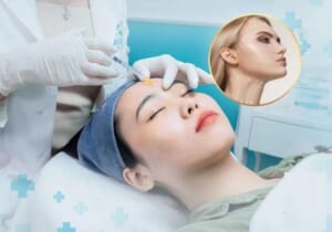 Các loại filler được Bộ Y tế cấp phép tại Việt Nam hiện nay