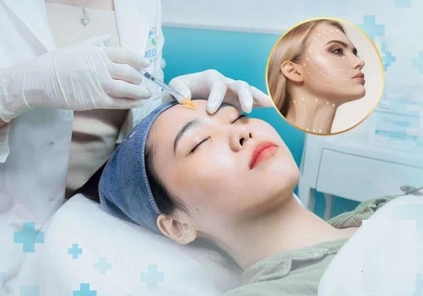 Các loại filler được Bộ Y tế cấp phép tại Việt Nam hiện nay