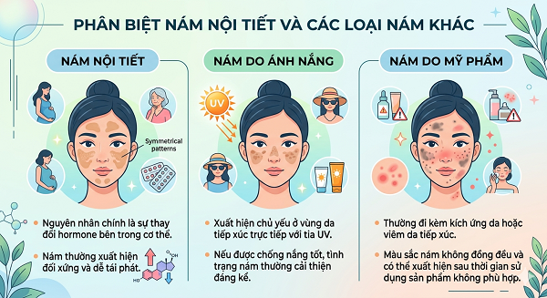 Nám nội tiết và cách nhận biết